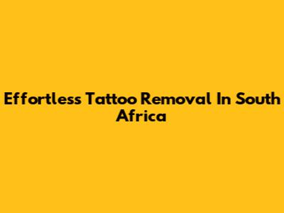 Effortless Tattoo Removal In South Africa
